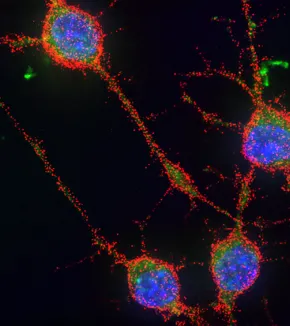 Signaling and neurodegenerative diseases