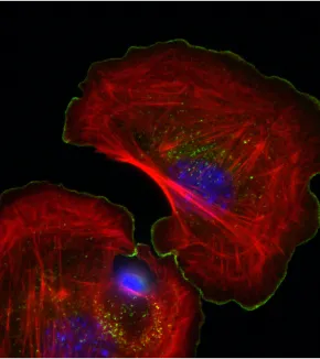 Cytoskeleton and cell morphogenesis