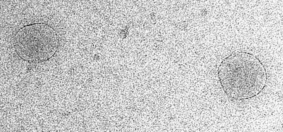 Exosome secretion: beyond simple membrane fusion