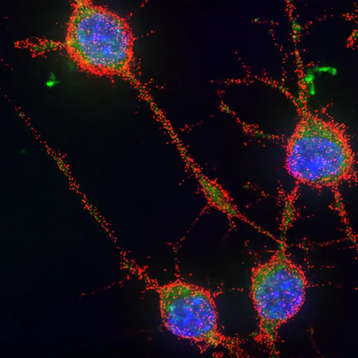 Signaling and neurodegenerative diseases