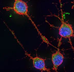 Signaling and neurodegenerative diseases