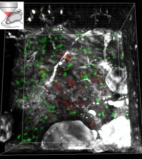 3-photon microscopy for deep-tissue imaging
