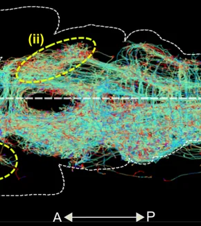 Large-volume bioimage informatics