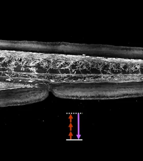 Label-free THG microscopy
