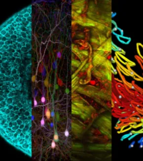 Microscopies avancées