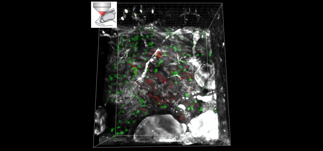 3-photon microscopy for deep-tissue imaging