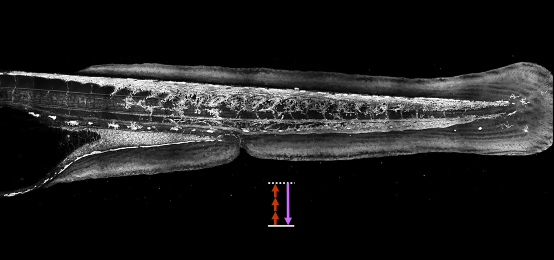 Third harmonic generation (THG) microscopy