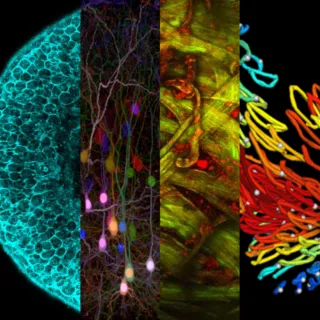 Advanced microscopies and tissue physiology