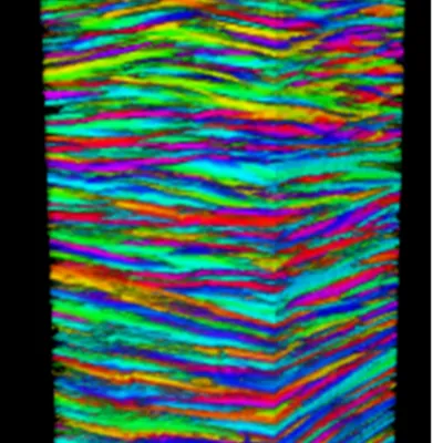 Mapping the structure of human corneas