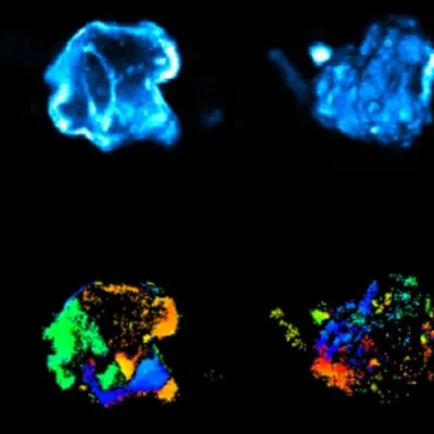 Multiphoton imaging of kidney stones