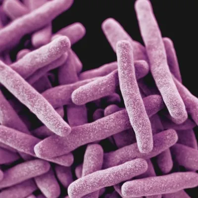 Des défauts dans les gènes de réparation de l’ADN favorisent l’émergence de la résistance aux antimicrobiens chez Mycobacterium tuberculosis