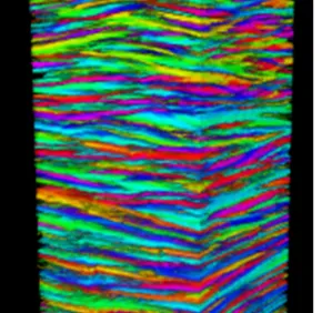 Cartographier la structure de la cornée humaine