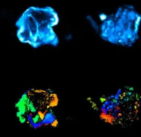 Imagerie multiphoton des calculs rénaux
