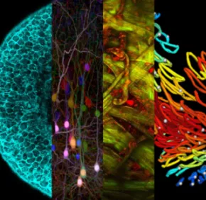 Microscopies avancées